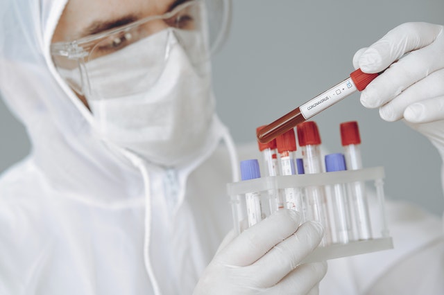 На Среднем Урале выявлено 109 новых случаев COVID-19. + 1 в Арамиле