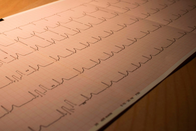 В сысертской больнице появился новый электрокардиограф | Сысертской ЦРБ на 265-летие подарили аппарат ЭКГ